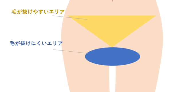 Vio脱毛の形はどれがいい 男ウケが良いアンダーヘアの形と正しい作り方を解説 Vio脱毛の形はどれがいい 男ウケが良いアンダーヘアの形と正しい作り方を解説